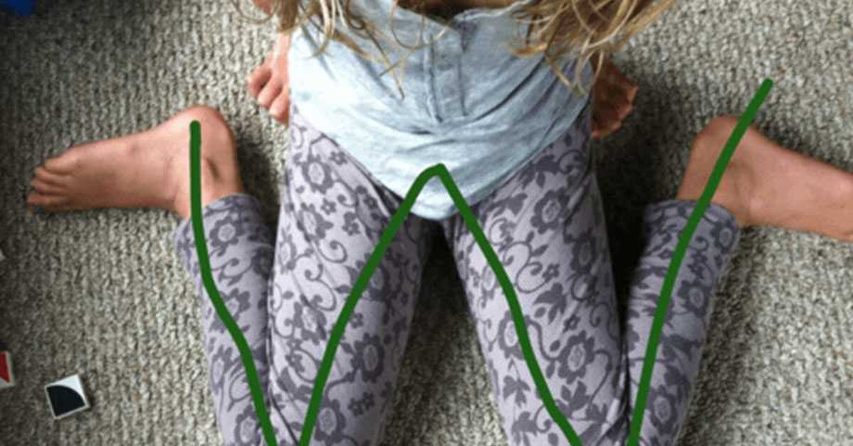 Çocuğunuz W oturuş pozisyonunda oturuyorsa onu hemen uyarın!