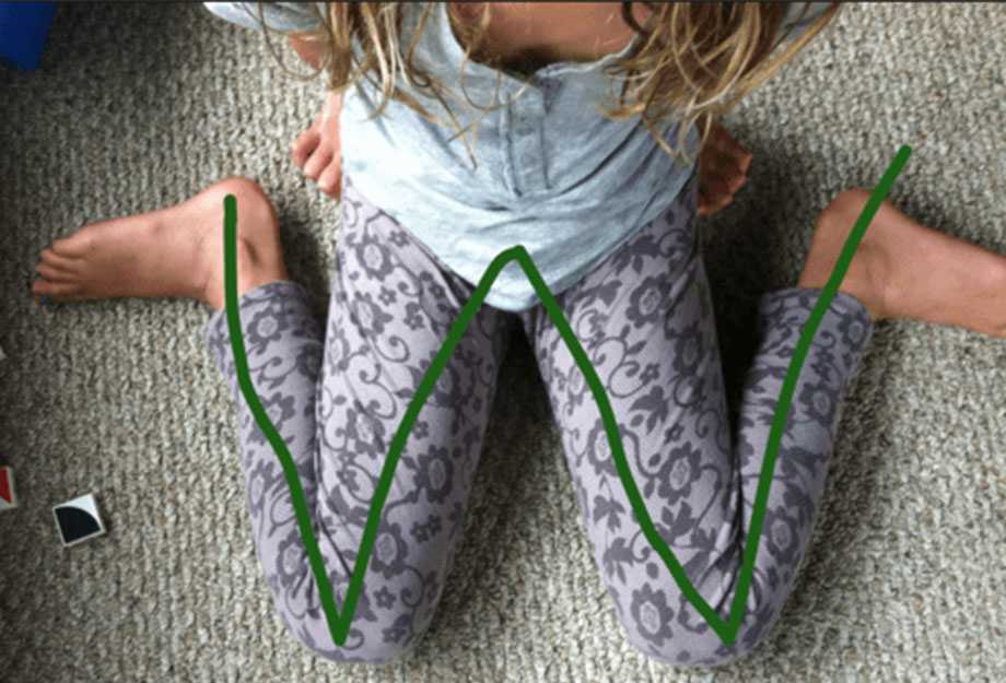 Çocuğunuz W oturuş pozisyonunda oturuyorsa onu hemen uyarın!