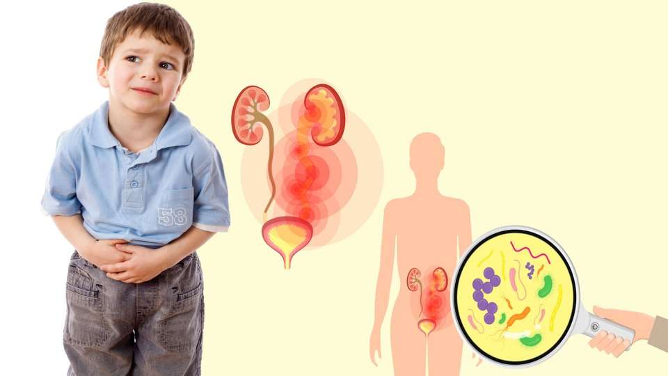 Çocuklarda İdrar Yolu Enfeksiyonu Belirtileri Nelerdir?