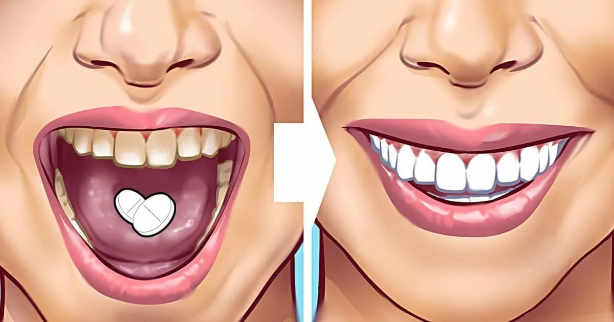 Çürük Dişleri Eski Haline Getiren Doğal Çözüm!