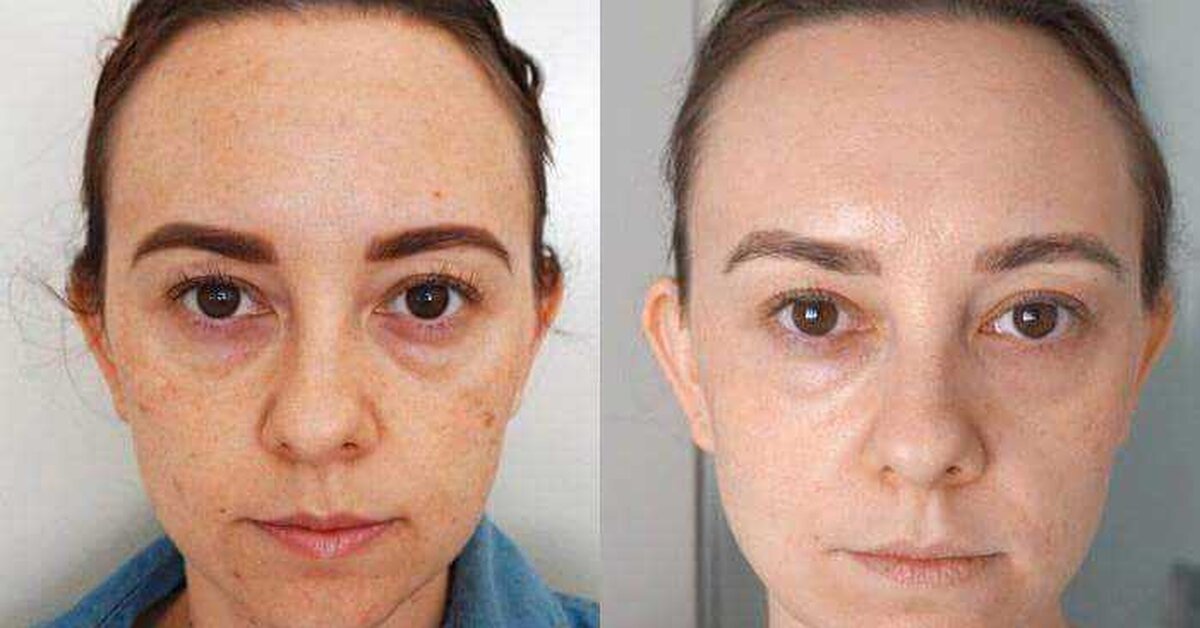 Gençleşmenize Yardımcı Olabilecek Kürleri İnceledik