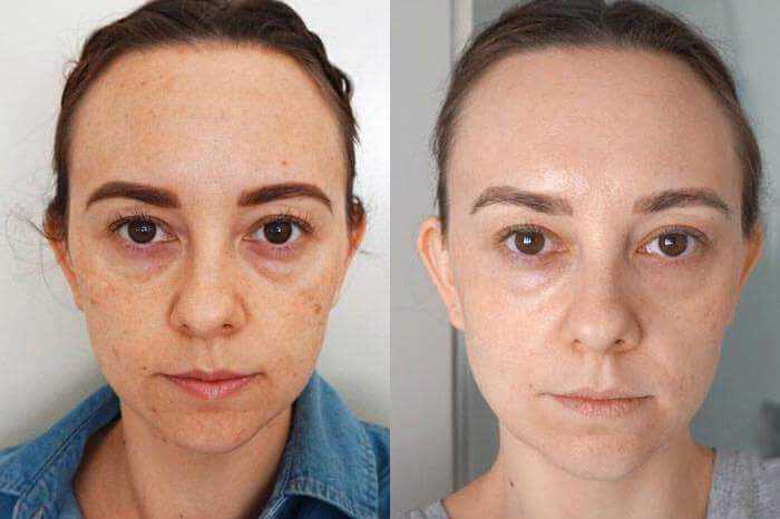 Gençleşmenize Yardımcı Olabilecek Kürleri İnceledik