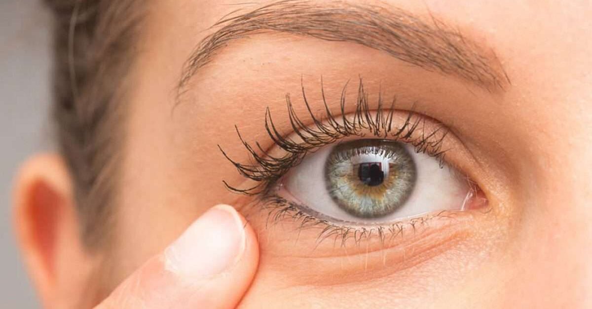 Göz altı kırışıklıkları için maske tarifi