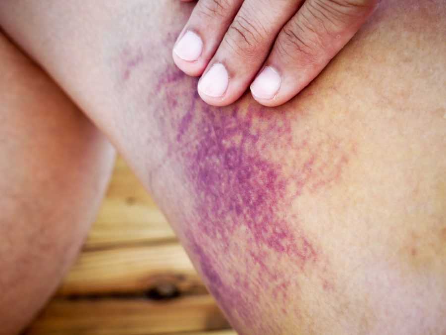 İbrahim Saraçoğlu’ndan Trombosit Düşüklüğü İçin Kür