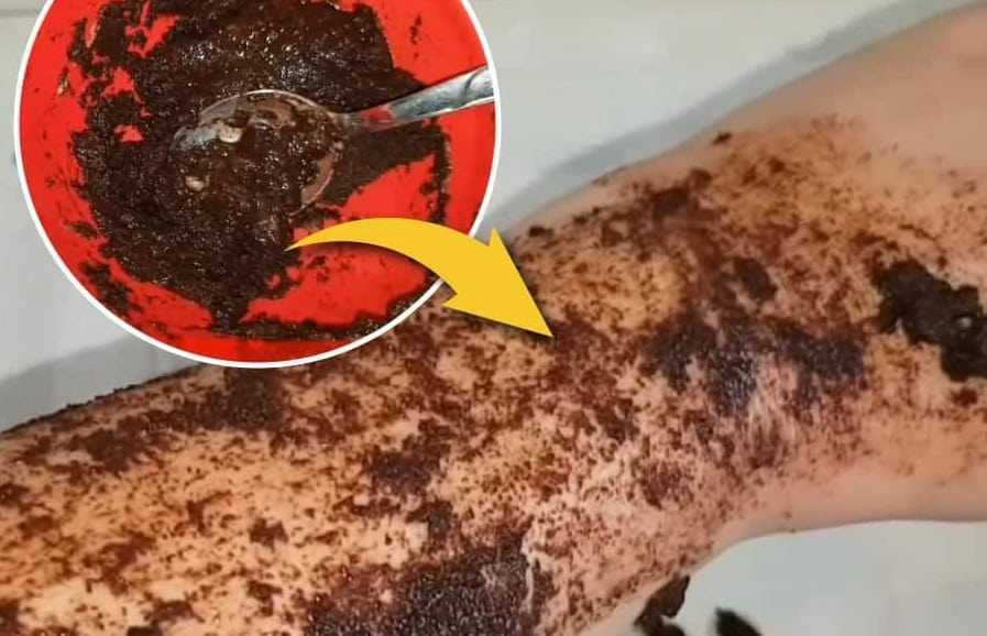 İstenmeyen Tüylerden Sonsuza Dek Kurtulun!