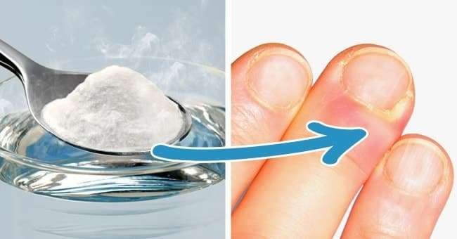 Karbonat Apseleri Tedavi Etmesi