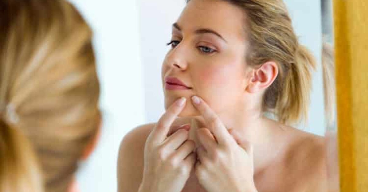 Kistik Akneler Nasıl Geçer?