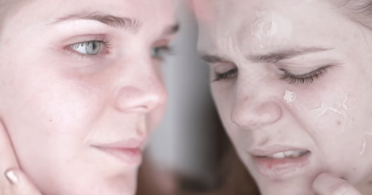 Kuruyan Ciltler İçin Yapmanız Gerekenler?