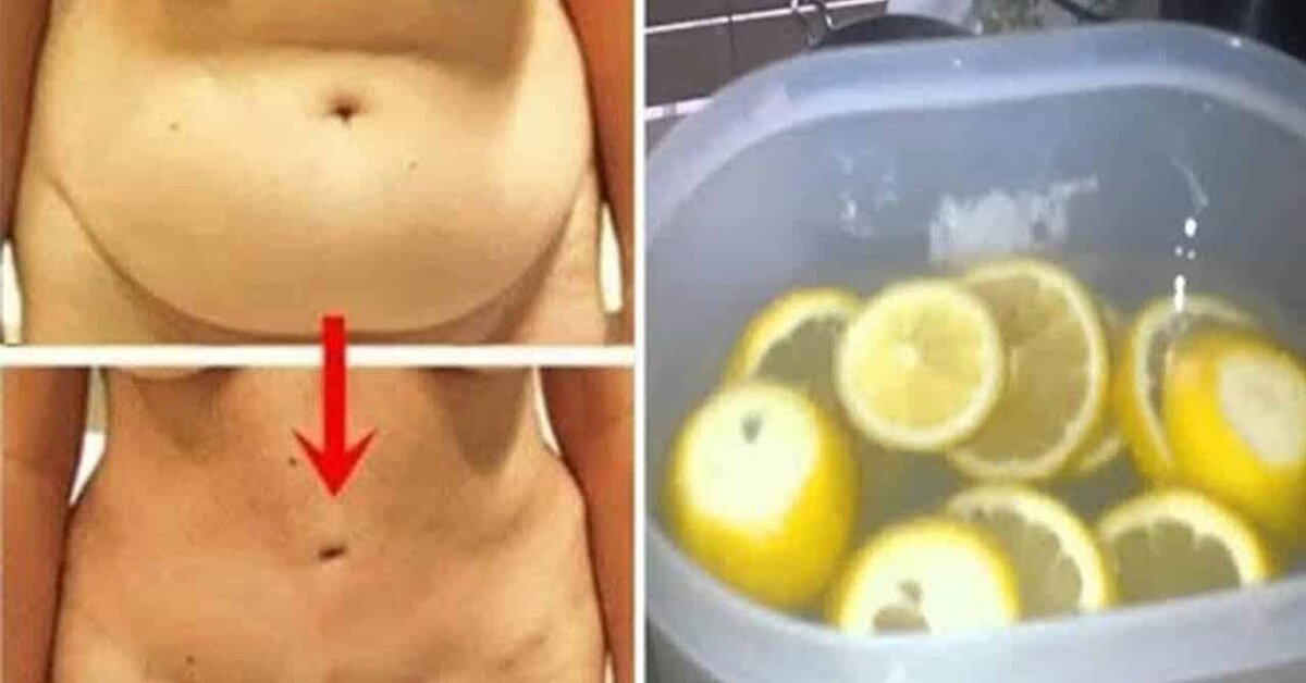 Limon, Zencefil ve Bal Kürü ile Sağlıklı Kilo Verme