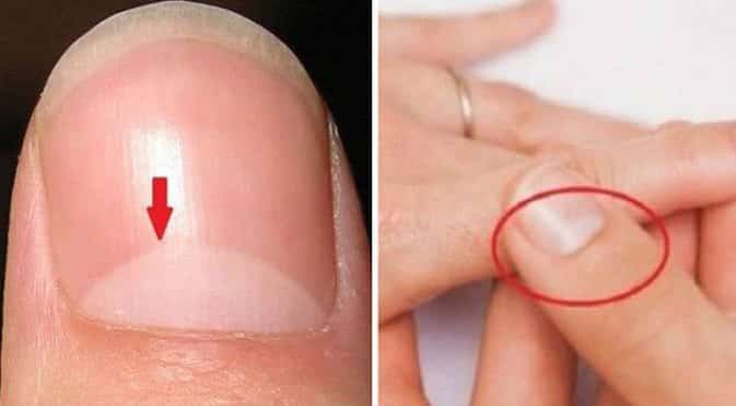 Aslında Bir Dahi Olduğunuzu Gösteren 10 İşaret!