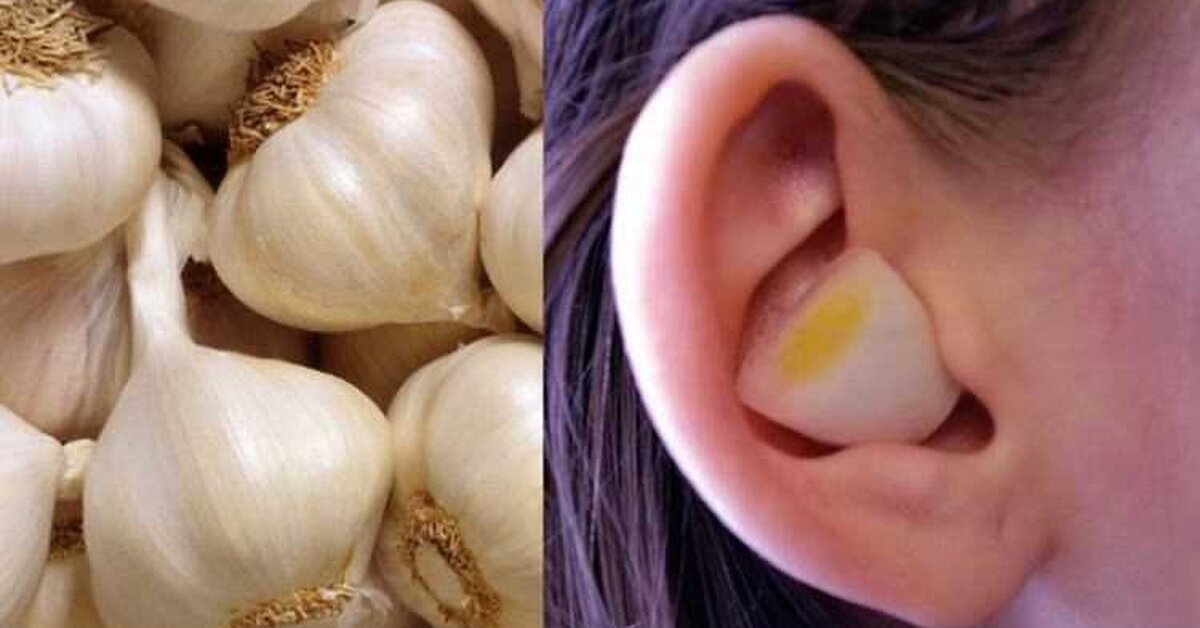 Oranıza Sarımsak ve Karanfili Koyun! Sonuca Şaşıracaksınız!