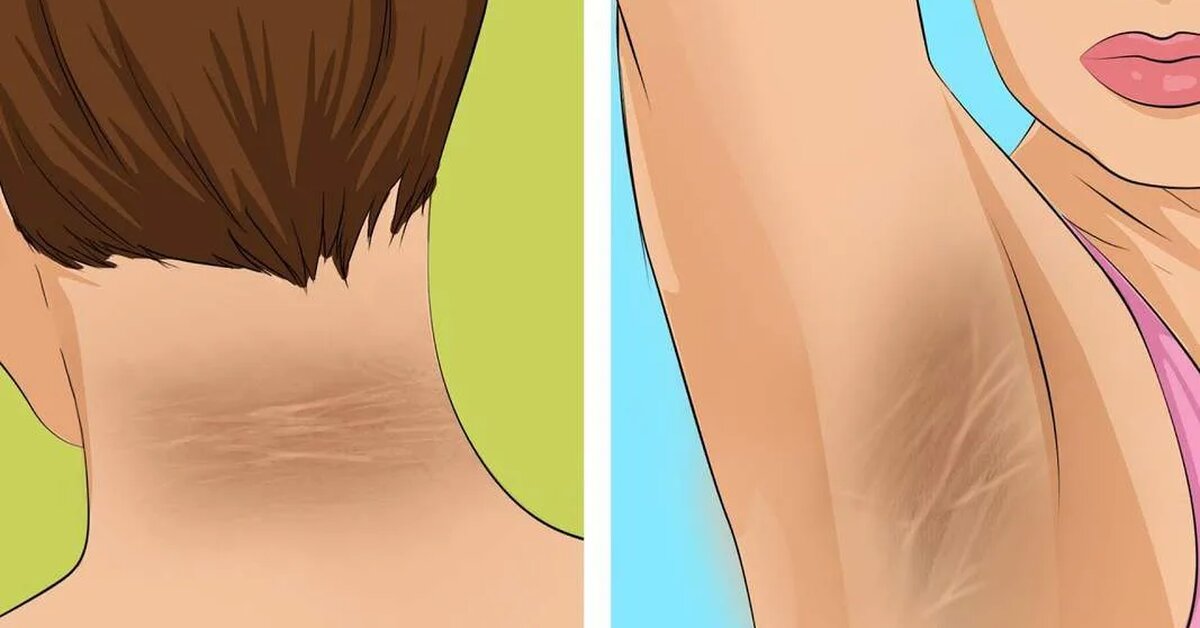 Şeker Hastalığının Bu Belirtilerine Dikkat Edin!