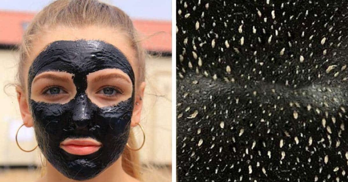 Siyah Noktaları Siyah Maske ile Yok Edin!