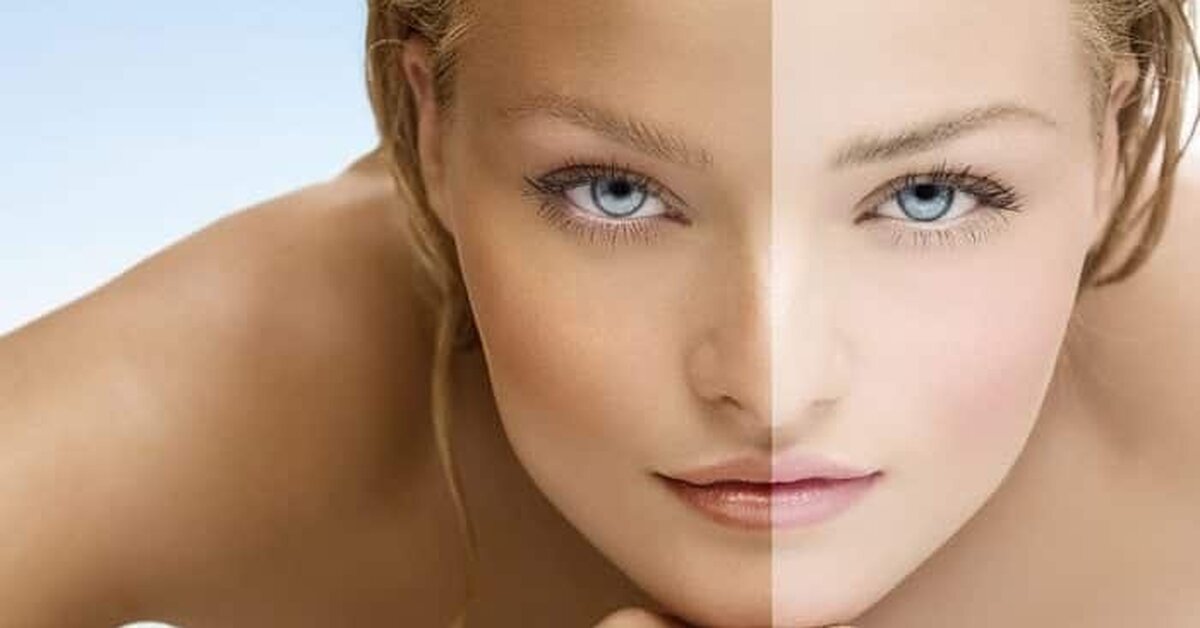 Ten Rengi Nasıl Açılır?