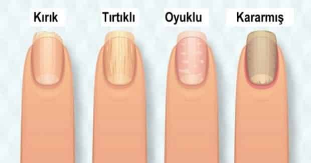Tırnaklar Sağlığınız Hakkında Ne Diyor?