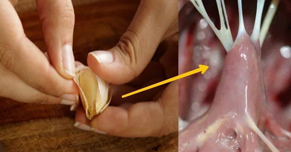 Uyumadan Önce Bir Diş Sarımsak Yutarsanız, Uyurken Bakın Neler Oluyor