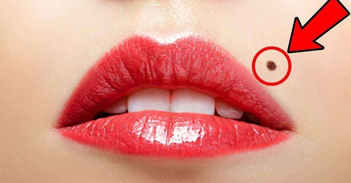 Vücudunuzdaki Benler Kişiliğiniz Hakkında Ne Söylüyor?