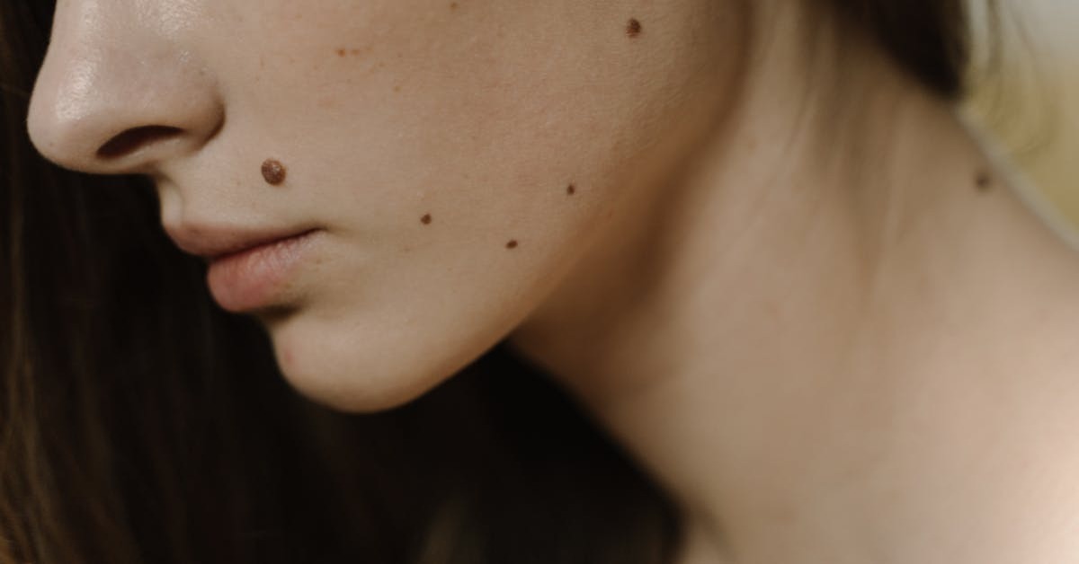 Vücudunuzdaki Benlerde Saklı Gerçekler: Renk, Şekil ve Risk Haritası