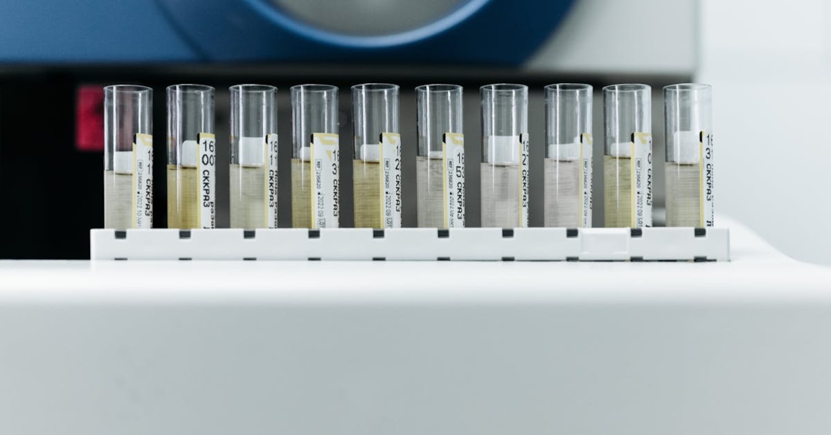 Laboratuvar tüpünde hormon testi