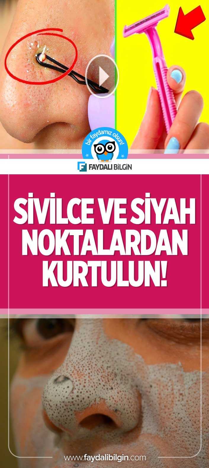 Sivilce ve Siyah Noktalardan Kurtulmak İçin Bu Basit Numaraları Deneyebilirsiniz. #sivilce #siyahnokta #ciltbakımı #maske #yüz #güzellik #akne #ciltsorunları #ipucu #kadın #bakım #makyaj