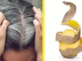Sadece Patates Kullanarak Oluşan Beyaz Saçlardan Kurtulun!