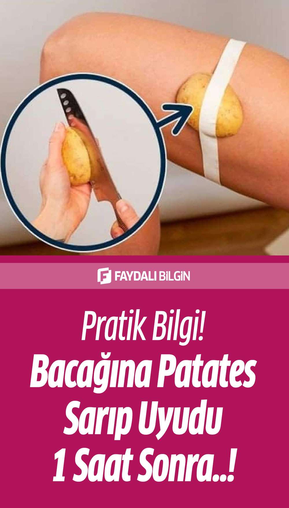 bacağına patates sarıp uyudu 1 saat sonra!