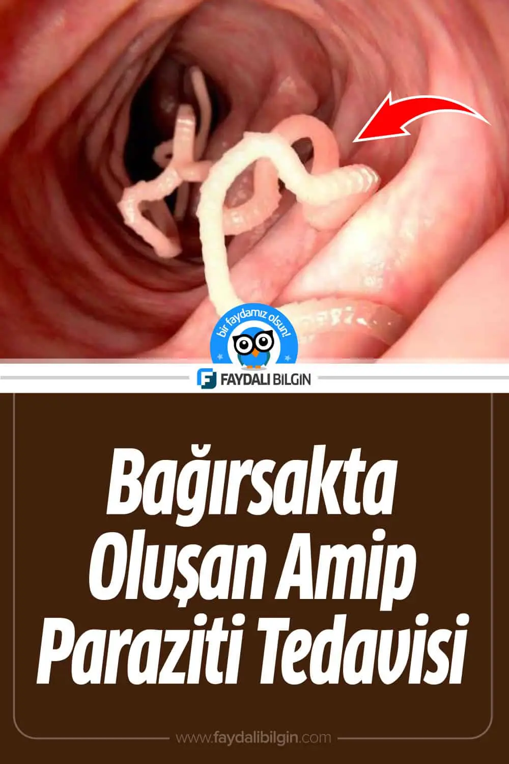 bağırsakta oluşan amip paraziti tedavisi i̇çin bitkisel kür