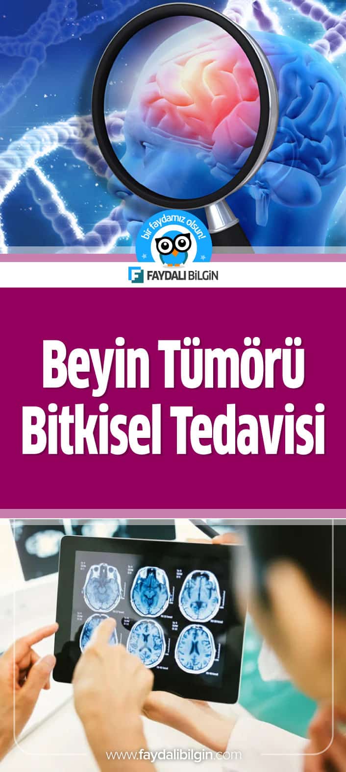Prof. İbrahim Saraçoğlu Beyin Tümörü Tedavisi İçin Bitkisel Kür Tarifi Veriyor. Beyin Tümörü Belirtileri, Beyin Tümörü Tedavisi, Bitkisel Tedavisi İbrahim Saraçoğlu. #beyin #beyintümörü #bitkiseltedavi #ibrahimsaraçoğlu #saraçoğlu #profsaraçoğlu #doğal #tedavi #tümör #sağlık