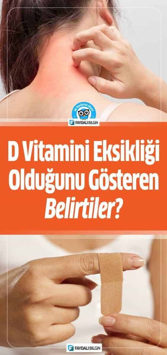 D Vitamini Eksikliğiniz Olduğunu Gösteren Belirtiler