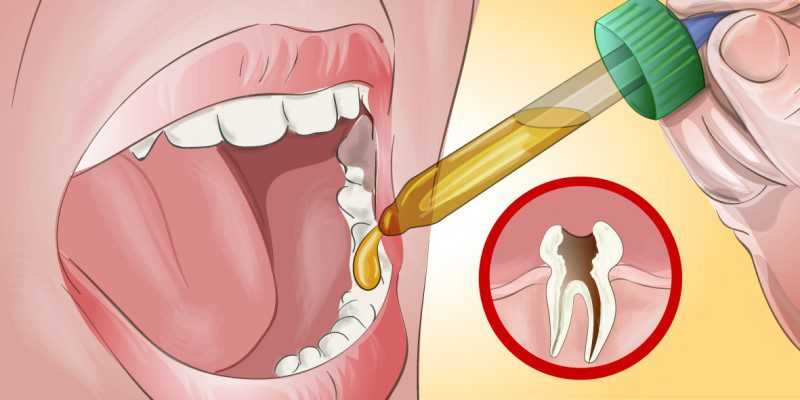 Diş ağrısından kurtulmak için mutlaka deneyin