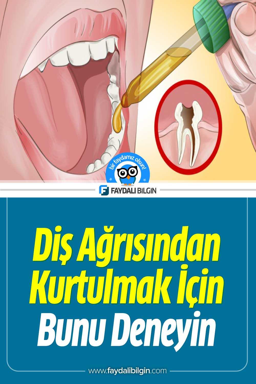diş ağrısından kurtulmak için mutlaka deneyin