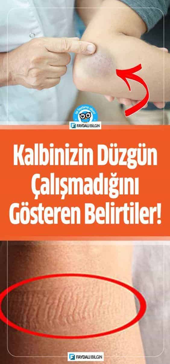 Kalbinizin Düzgün Çalışmadığını Gösteren Belirtiler