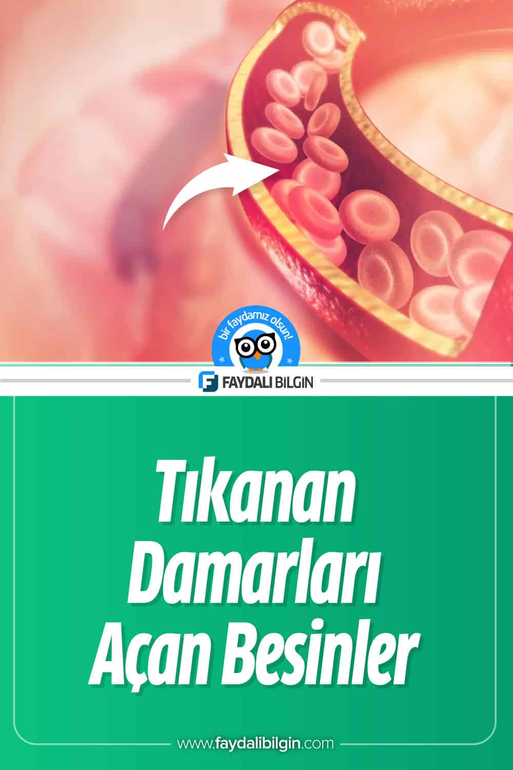 Tıkanan Damarları Açan Besinler