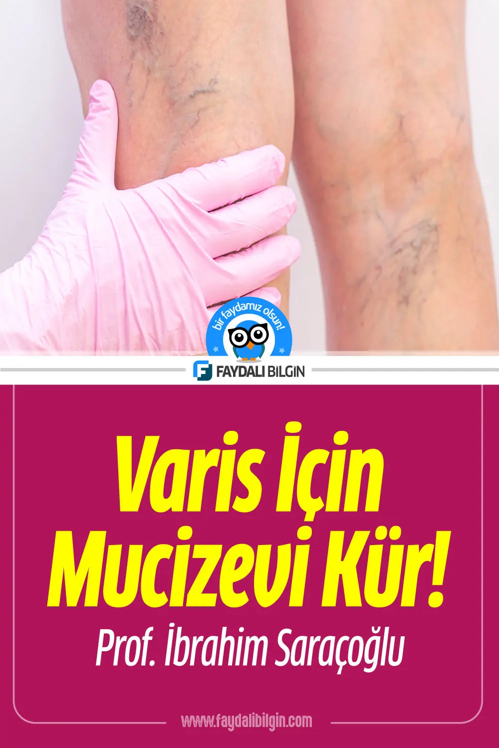 varis tedavisi i̇çin bitkisel kür