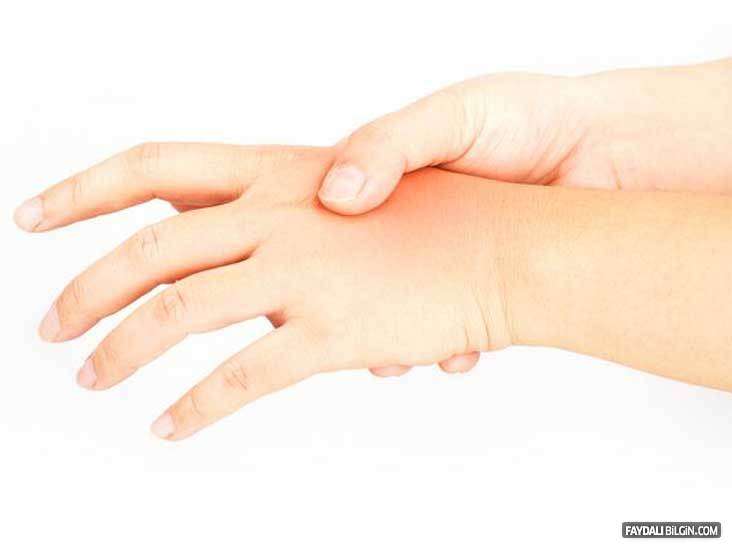 Ellerde uyuşma ve karıncalanma