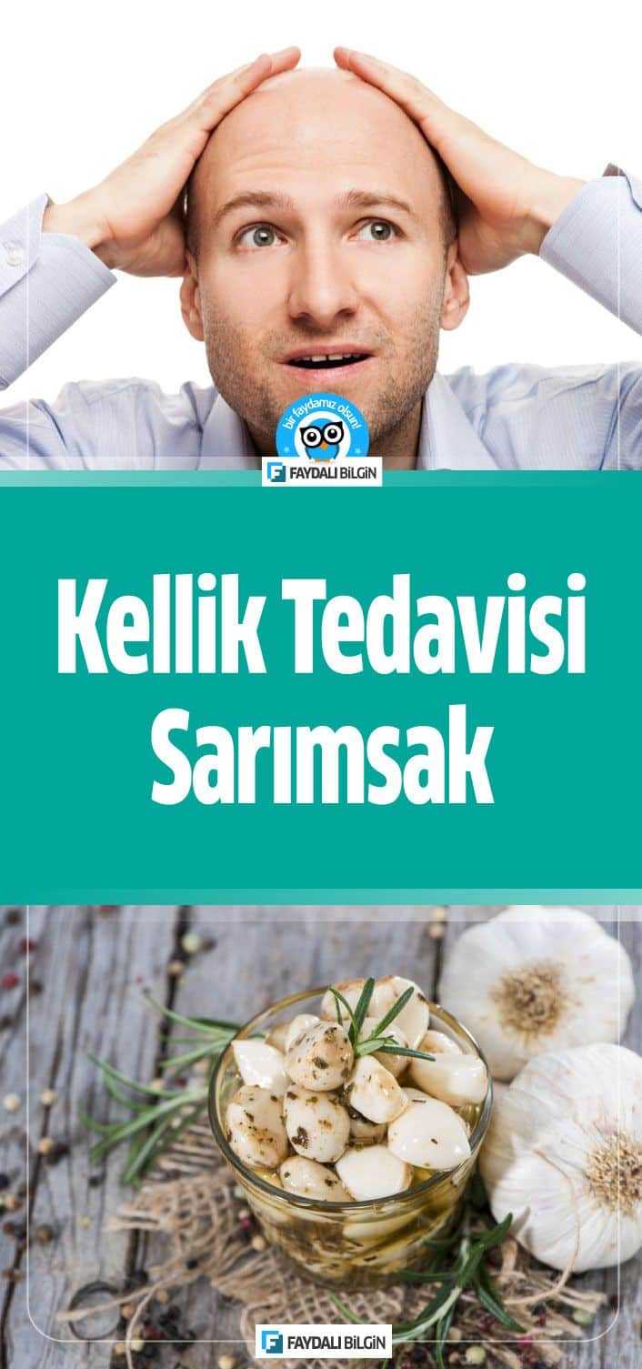 Kellik, belli bir aşamada çoğu erkekte gelişen yaygın saç dökülmesi tipidir. İşte Kellik Tedavisi için Sarımsak Kürleri. #kellik #kelliktedavisi #sarımsak #sarımsakkürü