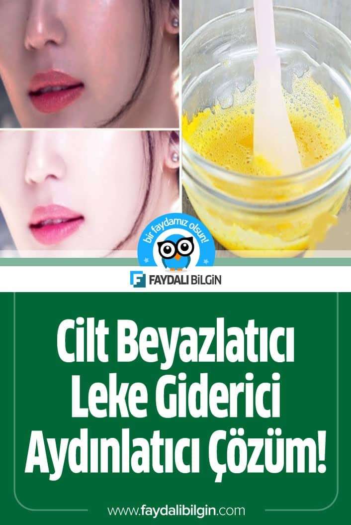 Cildimizin rengini nasıl açabiliriz? Cildimizdeki lekeleri nasıl yok edebiliriz? İşte çözüm maske tarifimiz. #cilt #ciltbakımı #maske #lekeler #ciltsorunları #beyazlatma