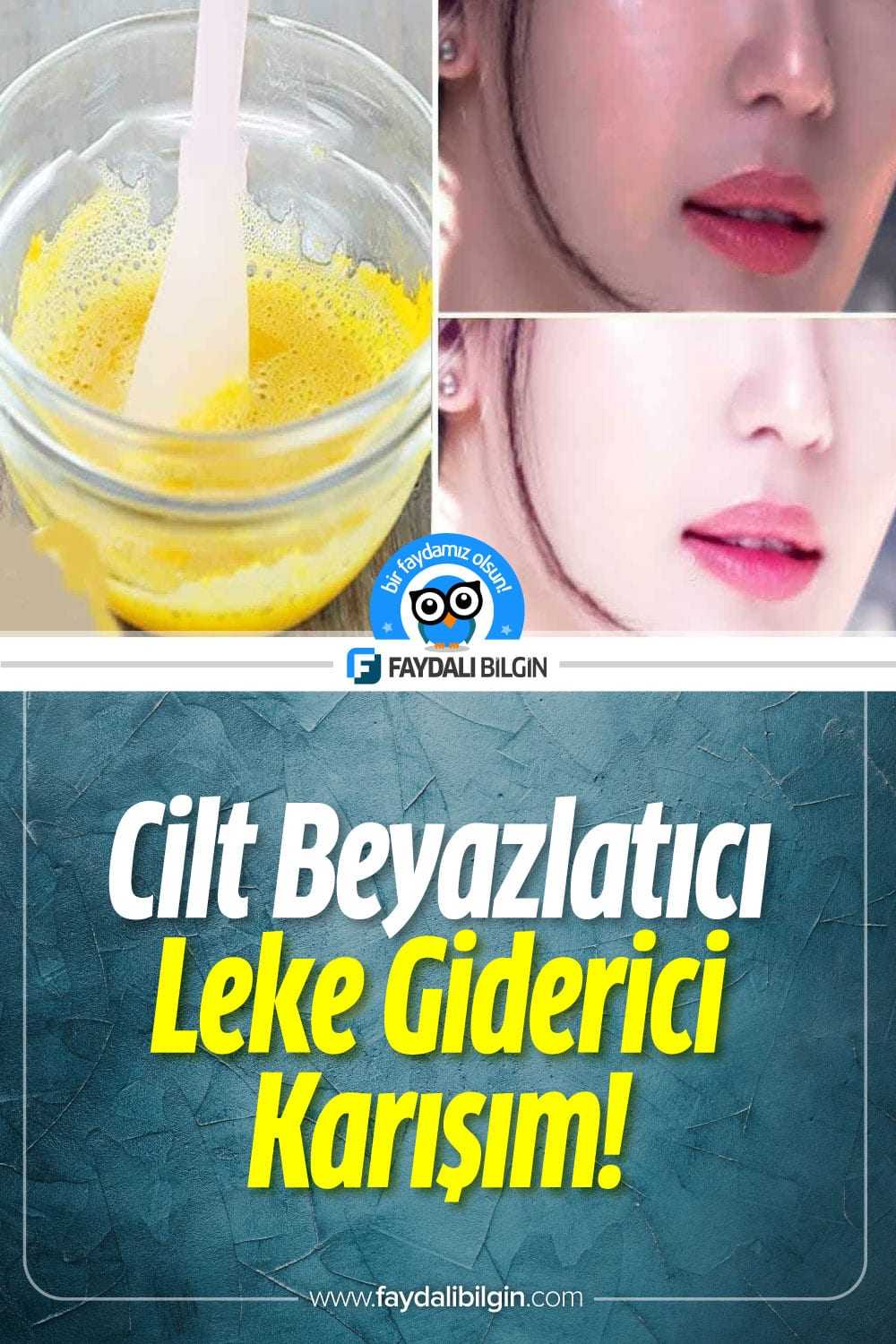 Cilt Beyazlatıcı Leke Giderici Aydınlatıcı Çözüm!