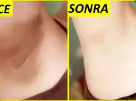Kararmış Koltuk Altı ve Bikini Bölgesi Nasıl Beyazlatılır?