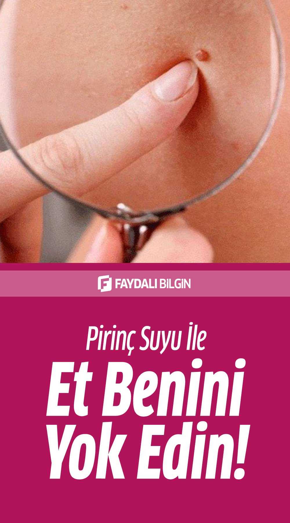 et beninden kurtulmanın doğal yolları