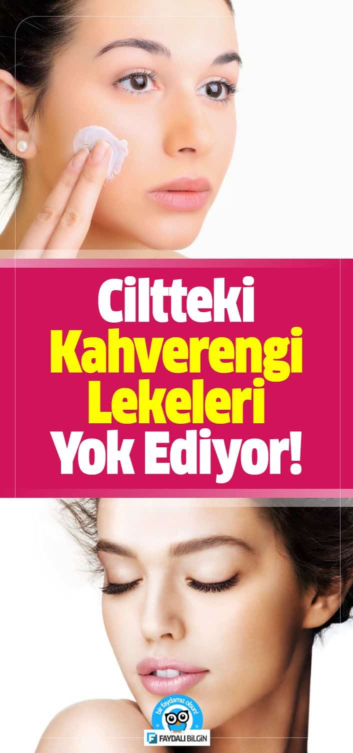 Kahverengi lekeleri genellikle yüz, sırt, boyun, göğüs, omuzlar ve eller gibi güneşe maruz kalan alanlarında görülür, bunun dışında yaşlanma ve genetik faktörlerde kahverengi lekeler oluşturur.