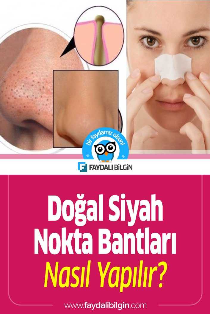 doğal siyah nokta bantları nasıl yapılır?