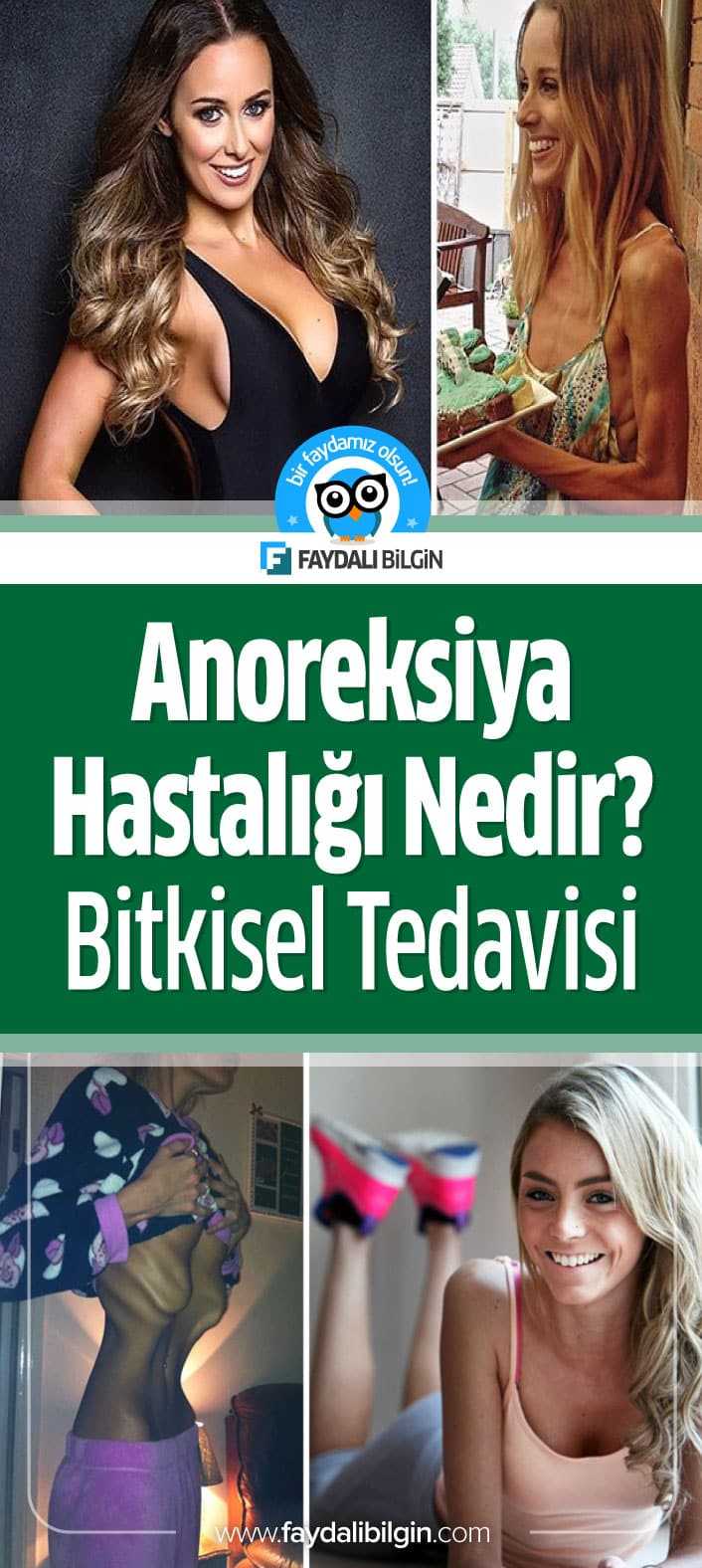 anoreksiya hastalığı nedir, bitkisel tedavisi