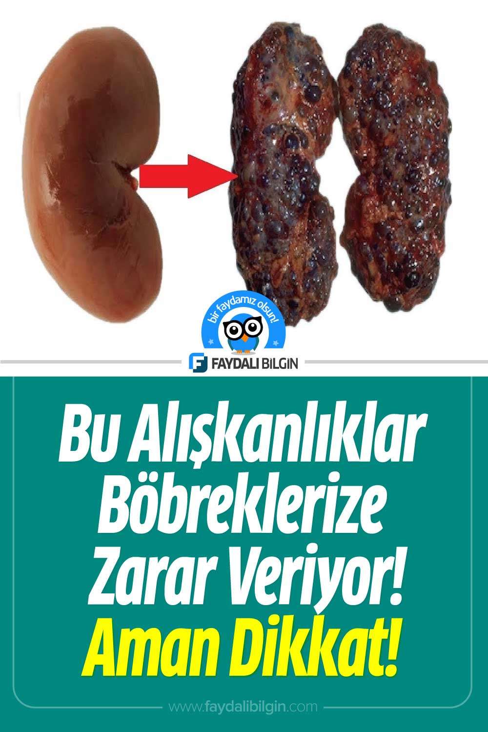 böbreklere zarar veren alışkanlıklar