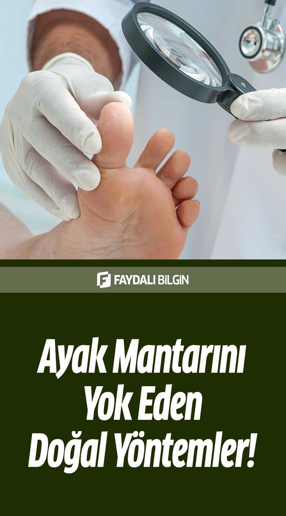 ayak mantarını yok eden doğal yöntemler!