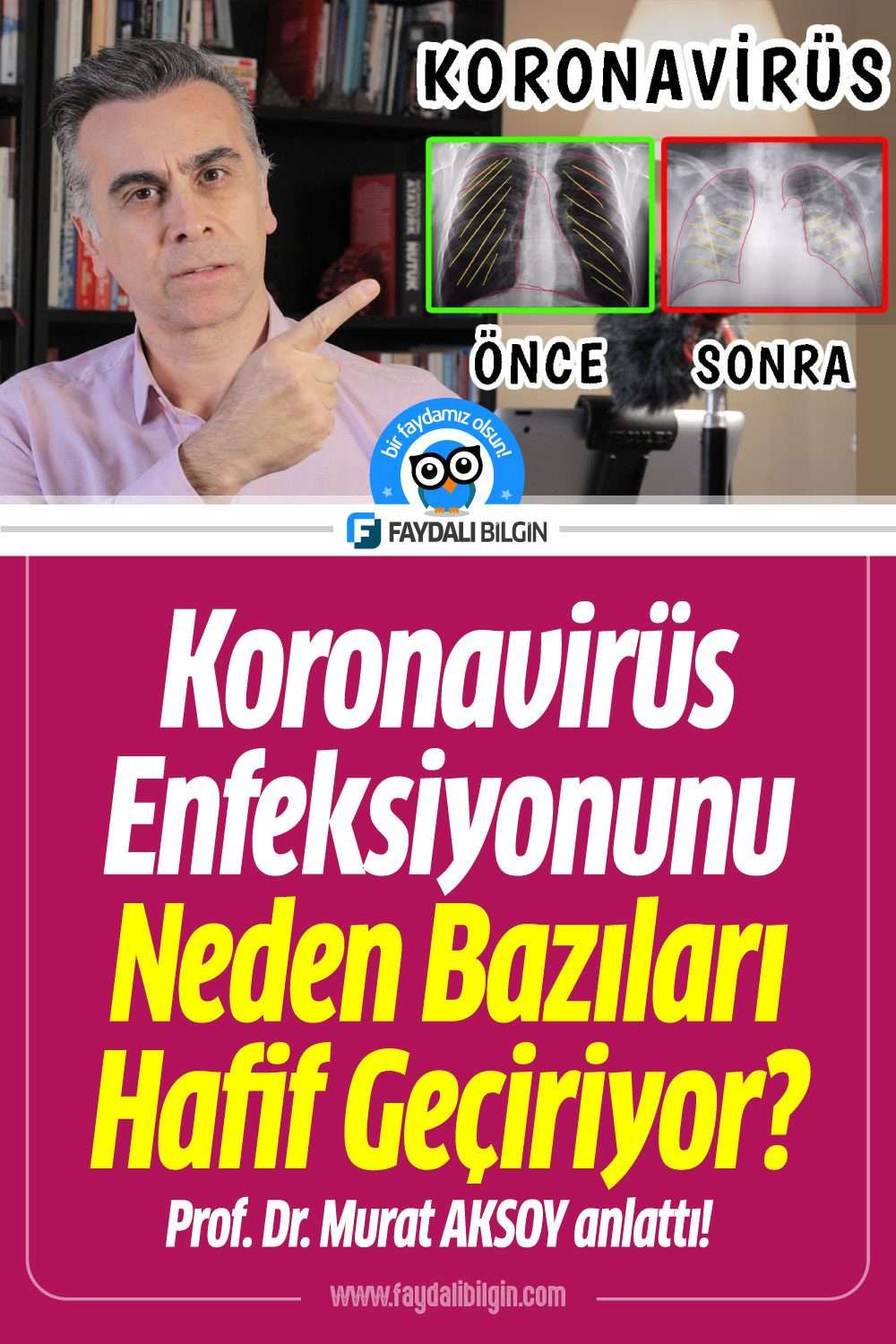 koronavirüs enfeksiyonunu neden bazıları hafif geçiriyor?